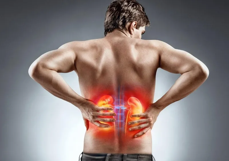 Người bị sỏi thận nên hạn chế tiêu thụ củ từ