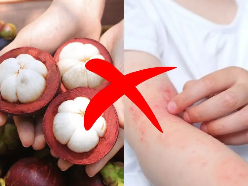 Những người có tiền sử dị ứng cần thận trọng khi thưởng thức măng cụt để tránh phản ứng.