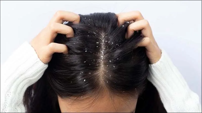 Bột lá dứa giúp loại bỏ gàu khi dùng làm dầu gội nhờ đặc tính kháng khuẩn