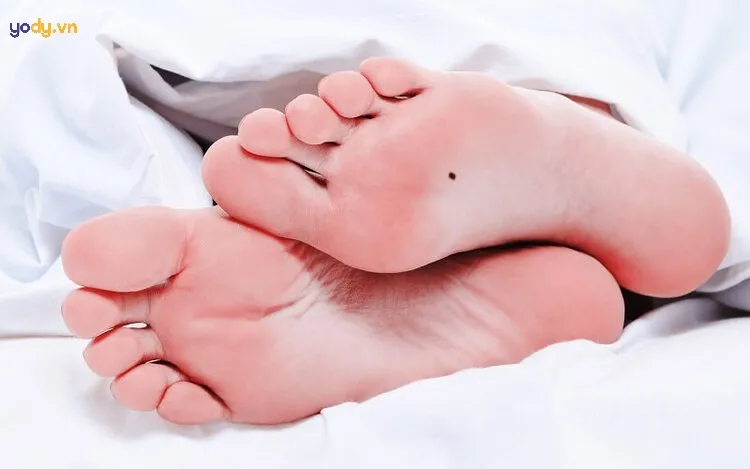 Nốt ruồi ở chân phải phụ nữ