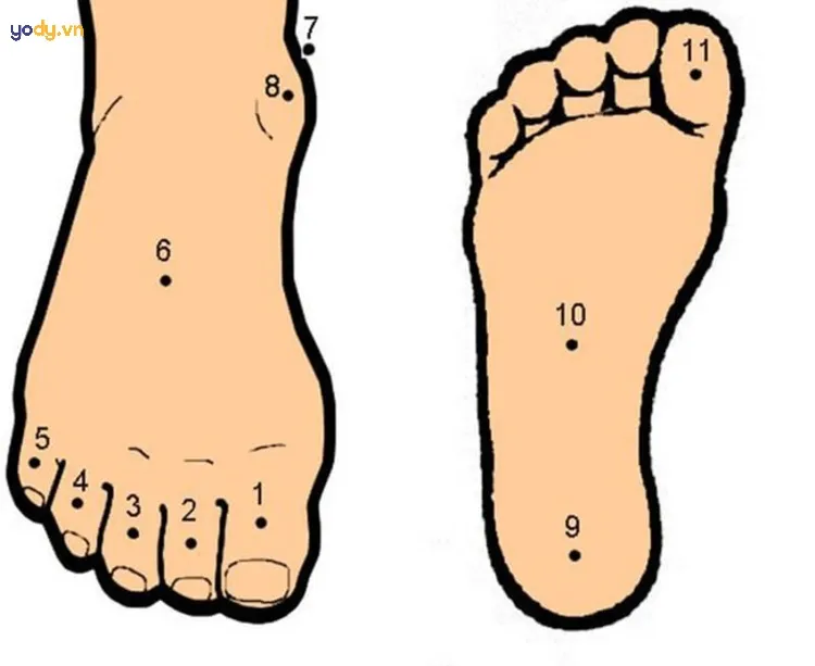 Nốt ruồi ở chân tốt hay xấu