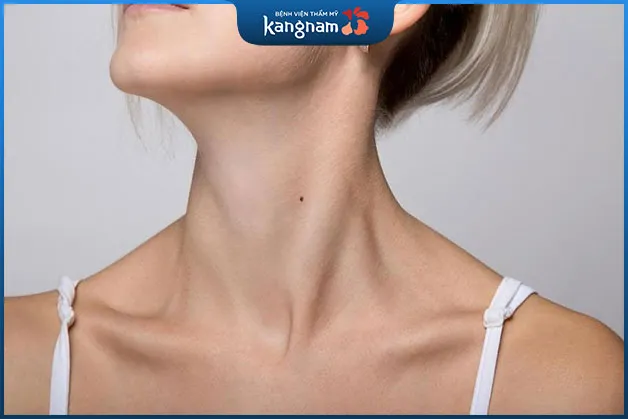 Những người có nốt ruồi ở cổ bên trái hay gặp khó khăn về tài chính