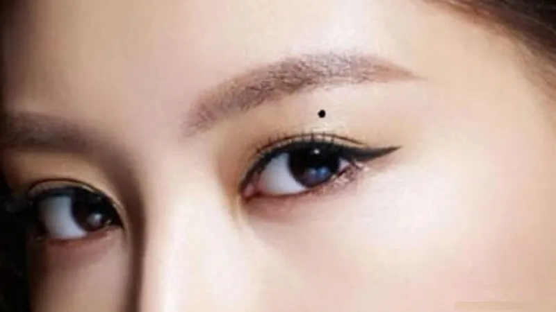 Nốt ruồi ở mắt có thể liên quan đến một vài bệnh lý