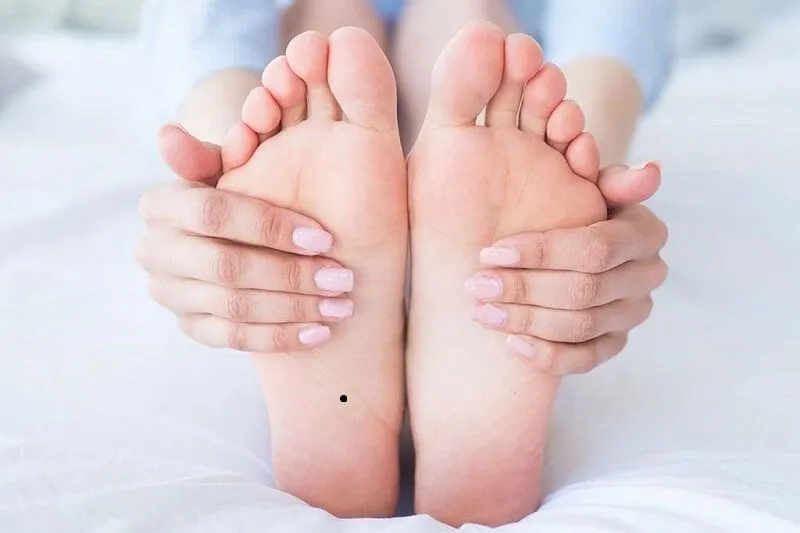 Nốt ruồi ở bàn chân phải