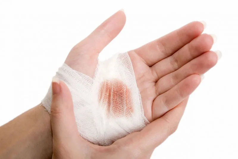 Lá non cây ô rô được dùng để cầm máu vết thương hở