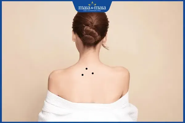3 nốt ruồi tam giác sau lưng