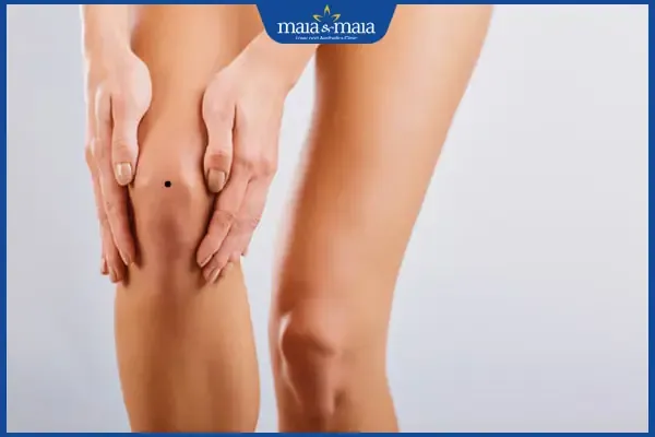 Hình ảnh một nốt ruồi mọc ở đầu gối