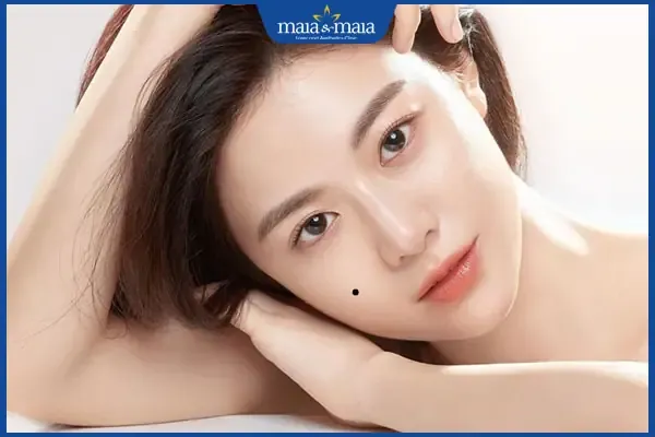 Người phụ nữ với nốt ruồi được cho là mang lại tài lộc và may mắn trên gương mặt
