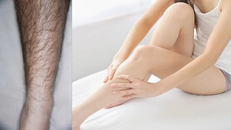 Nhựa sapoche có thể được dùng để tẩy lông chân và tay một cách tự nhiên