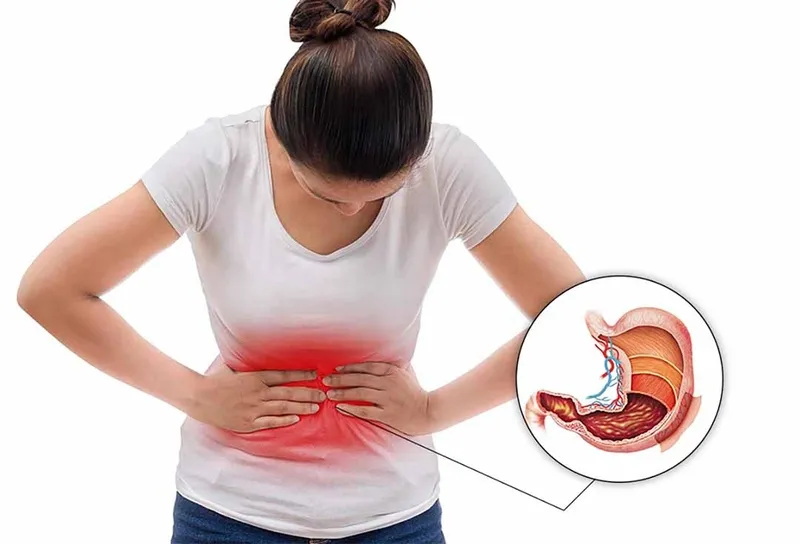 Đau dạ dày là một trong các tác hại của ăn cay