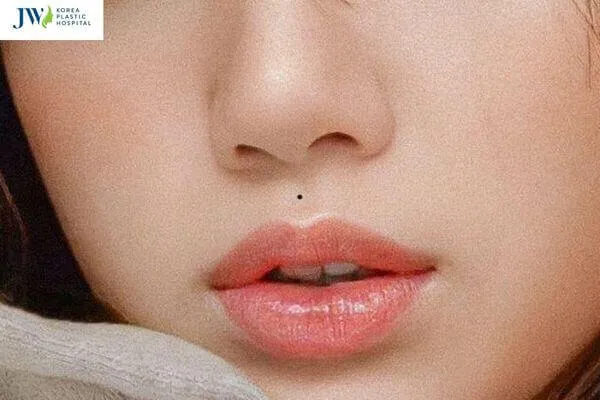 Người phụ nữ với nốt ruồi ở nhân trung, thể hiện sự lận đận trong tình duyên