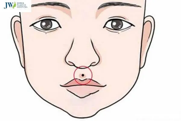 Ý nghĩa của nốt ruồi ở nhân trung nữ giới trong nhân tướng học