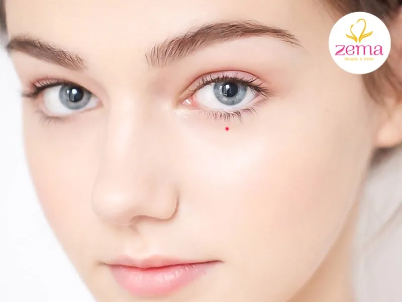 Nốt ruồi son ở dưới mắt trái