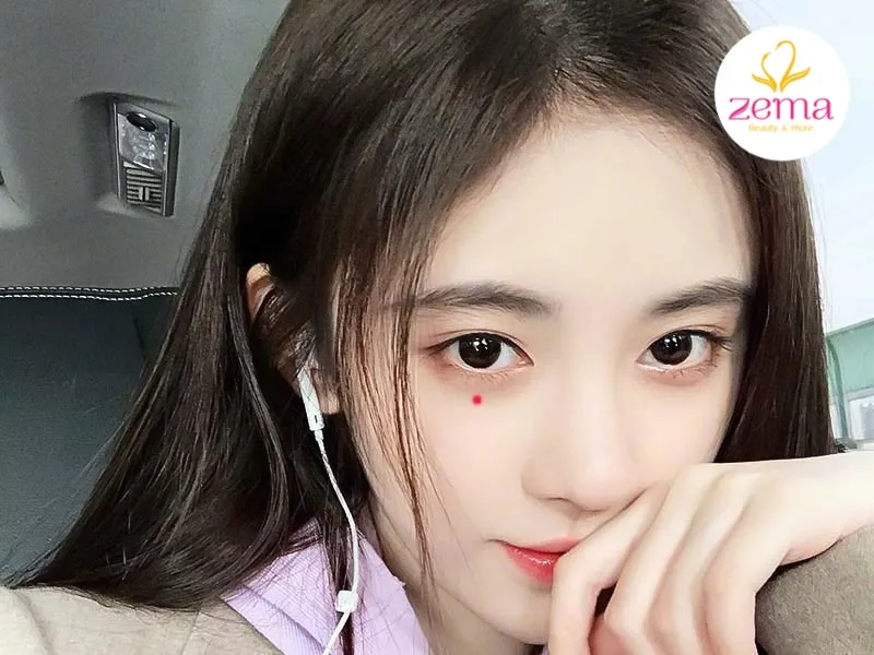 Nốt ruồi son ở dưới mắt phải