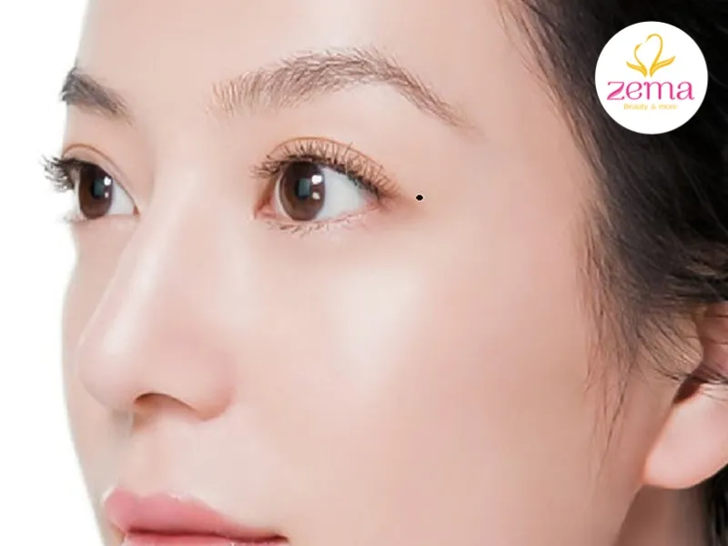 Nốt ruồi dưới mắt phụ nữ theo vị trí