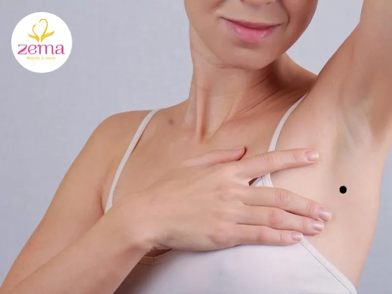 Nốt ruồi nằm ở dưới nách trái có tính cách cởi mở, vui vẻ và hòa đồng