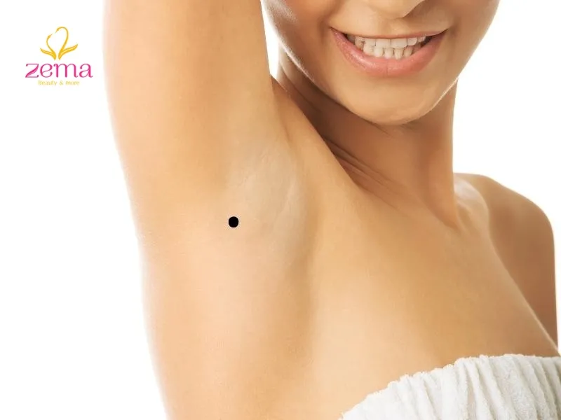 Nốt ruồi trong nách phải là dấu hiệu của một cuộc đời đầy gian nan