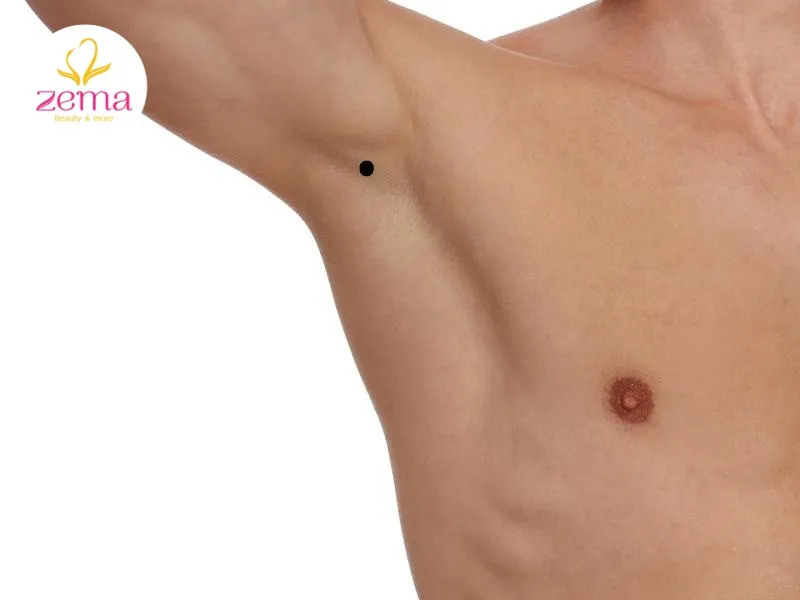 Nốt ruồi trong nách đàn ông có tướng số không mấy tốt đẹp