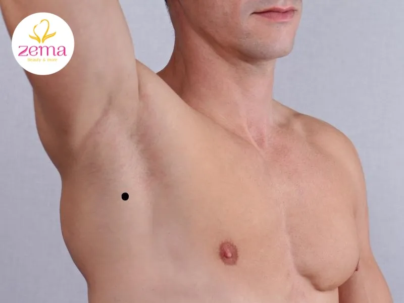 Nốt ruồi nằm ở dưới nách trái nam giới biểu hiện của một cuộc đời đầy khó khăn về cả tài chính và nhân duyên