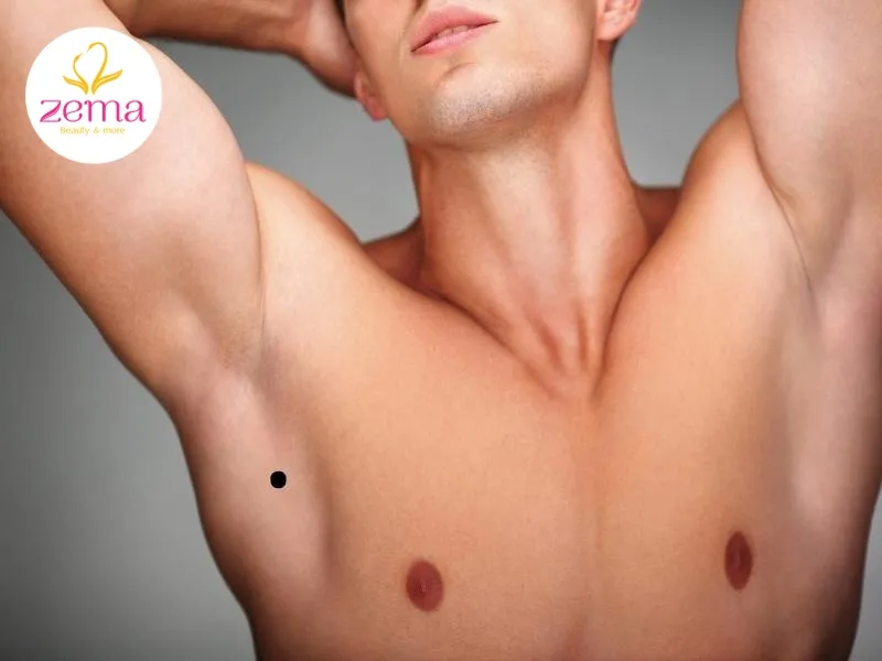 Nốt ruồi nằm ở gần nách phải nam giới biểu hiện của tính cách gia trưởng và thiếu sự nhất quán