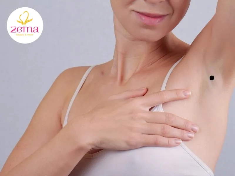 Người sở hữu nốt ruồi đen ở nách tận dụng mọi cơ hội để kiếm tiền và đạt được thành công