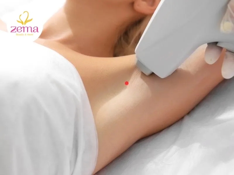 Nốt ruồi son ở nách là dấu hiệu của sự may mắn