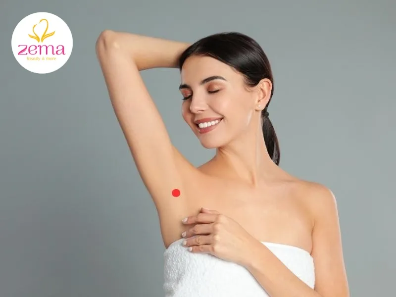 Nốt ruồi son dưới nách phải có ý nghĩa về tài lộc, vận may và thịnh vượng
