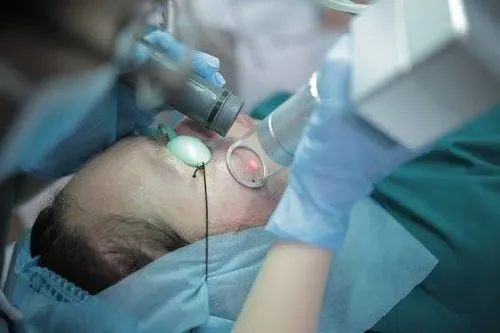 Phẫu thuật bằng laser điều trị vết bớt