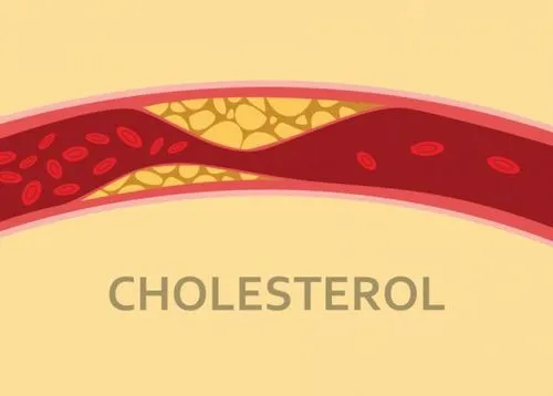 Hậu quả của việc dung nạp quá nhiều cholesterol từ trứng hoặc các thực phẩm khác đối với sức khỏe