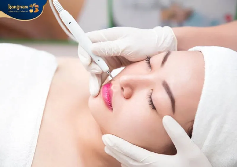 Thẩm mỹ Kangnam sử dụng công nghệ xóa nốt ruồi bằng laser.