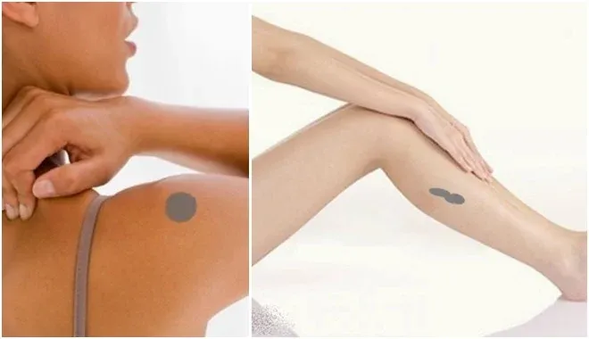 Vết bớt trên bắp chân có thể là dấu hiệu của sự xui xẻo và trắc trở