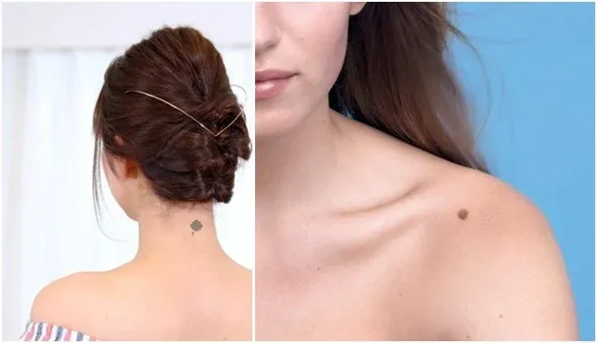 Vết bớt màu đỏ nằm ở đường trung trực sau gáy dự báo tình cảm trắc trở